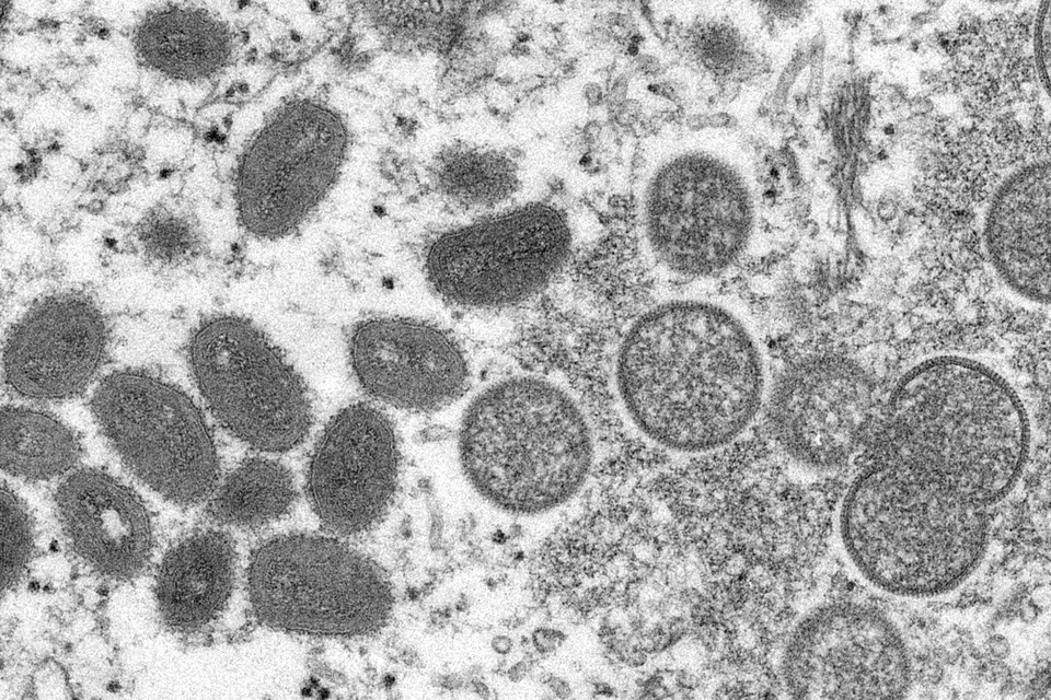 Beeld van viruspartikels van het apenpokkenvirus onder een elektronenmicroscoop. 