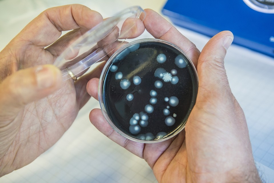 De legionellabacterie groeit trager dan andere bacteriën. 