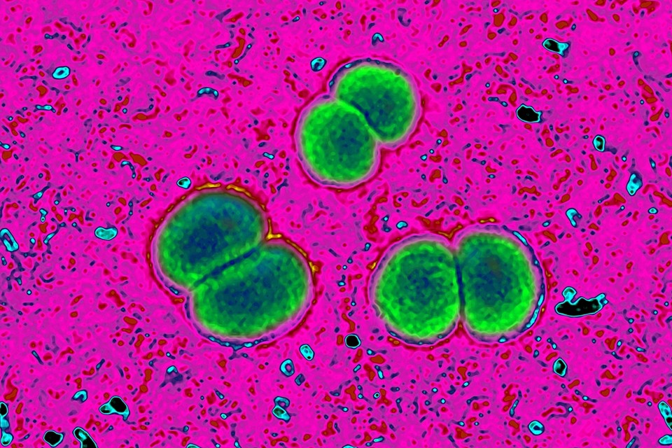 De meningokokken-bacterie, gezien onder de microscoop. 
