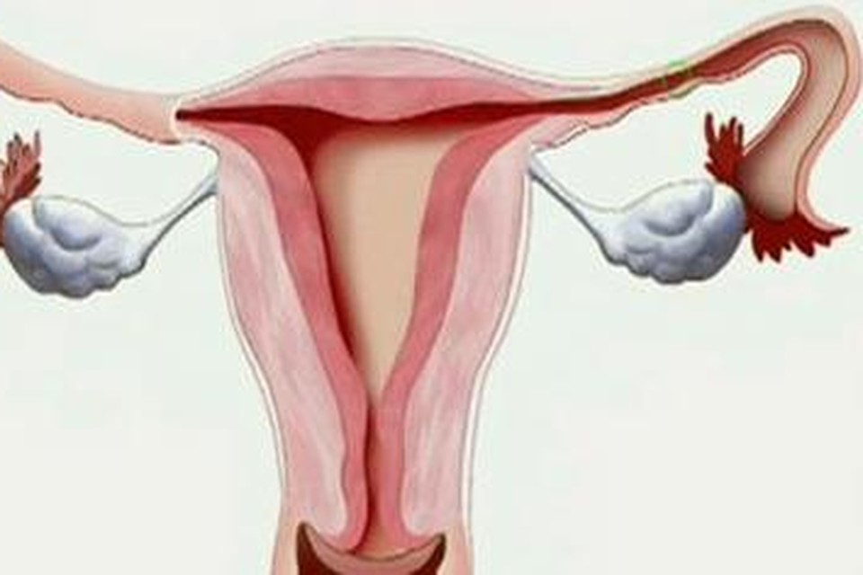 Eierstokkanker komt uit de baarmoeder