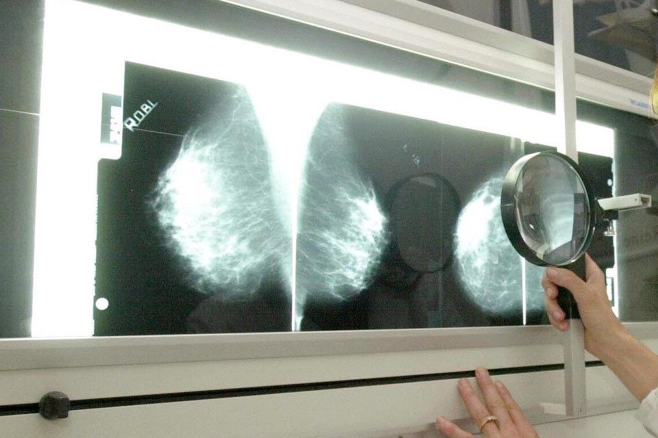Europa suggereerde om de doelgroep van vrouwen voor screening op borstkanker uit te breiden naar 45-74 jaar, waar dat nu nog 50-69 jaar is.  