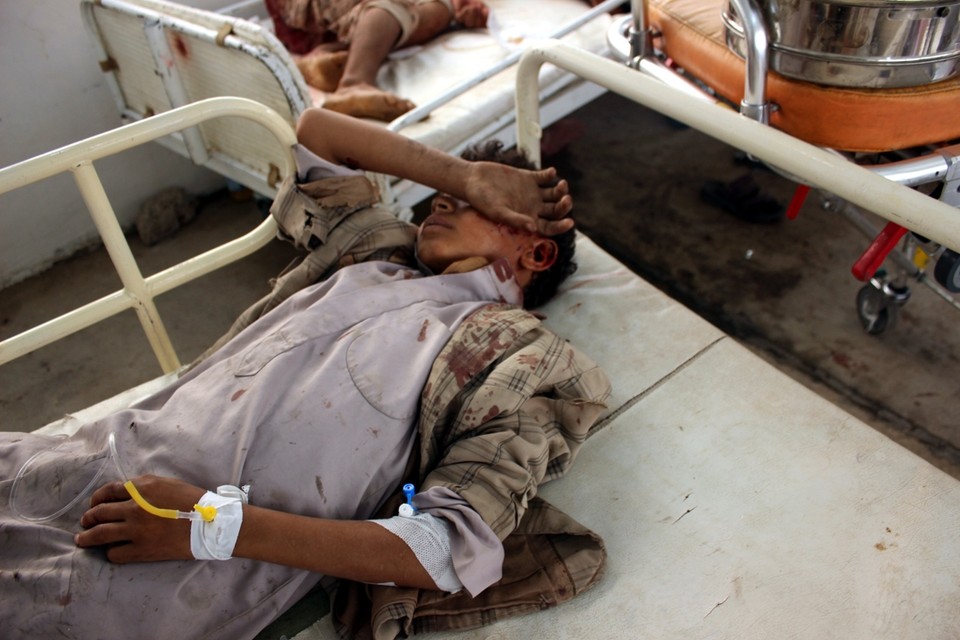 Gewonde kinderen liggen in een ziekenhuis in Jemen na een luchtaanval 
